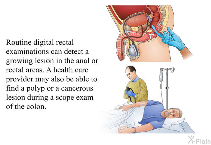 Routine digital rectal examinations can detect a growing lesion in the anal or rectal areas. A health care provider may also be able to find a polyp or a cancerous lesion during a scope exam of the colon.