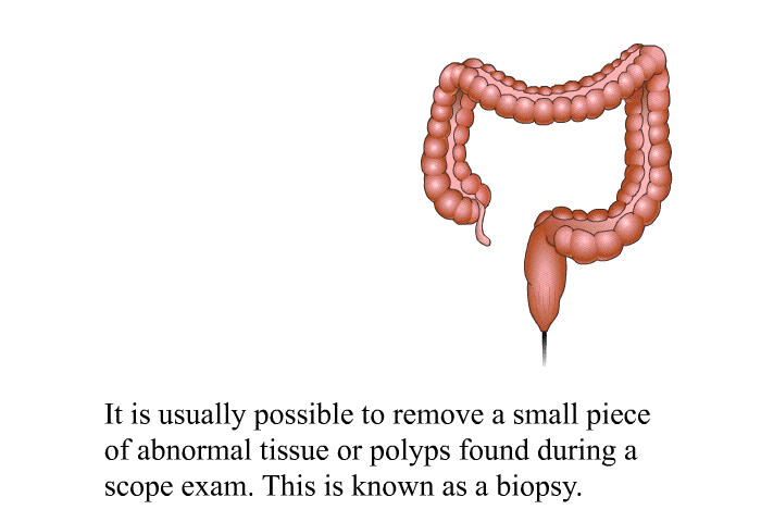 It is usually possible to remove a small piece of abnormal tissue or polyps found during a scope exam. This is known as a biopsy.