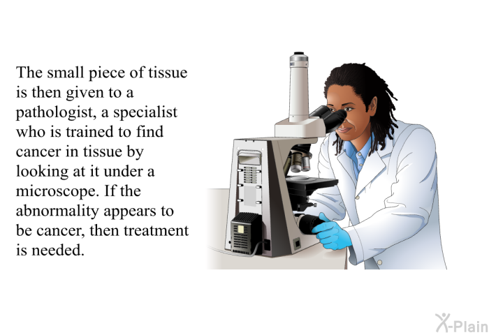 The small piece of tissue is then given to a pathologist, a specialist who is trained to find cancer in tissue by looking at it under a microscope. If the abnormality appears to be cancer, then treatment is needed.