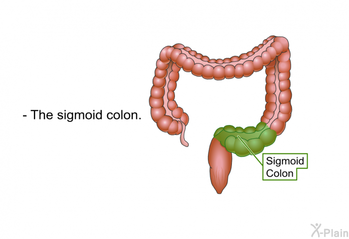 The sigmoid colon.