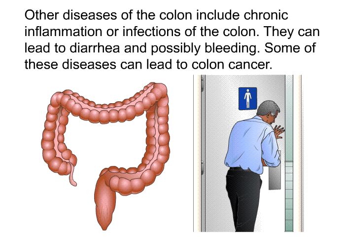 Other diseases of the colon include chronic inflammation or infections of the colon. They can lead to diarrhea and possibly bleeding. Some of these diseases can lead to colon cancer.