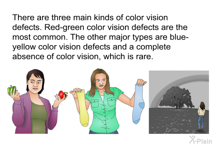 There are three main kinds of color vision defects. Red-green color vision defects are the most common. The other major types are blue-yellow color vision defects and a complete absence of color vision, which is rare.