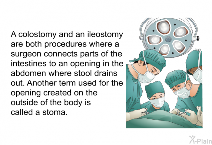 A colostomy and an ileostomy are both procedures where a surgeon connects parts of the intestines to an opening in the abdomen where stool drains out. Another term used for the opening created on the outside of the body is called a stoma.