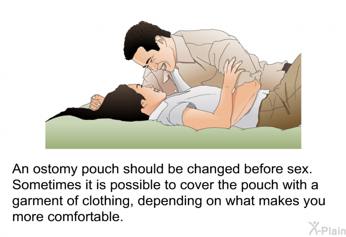 An ostomy pouch should be changed before sex. Sometimes it is possible to cover the pouch with a garment of clothing, depending on what makes you more comfortable.