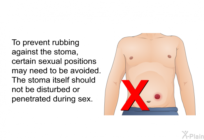 To prevent rubbing against the stoma, certain sexual positions may need to be avoided. The stoma itself should not be disturbed or penetrated during sex.