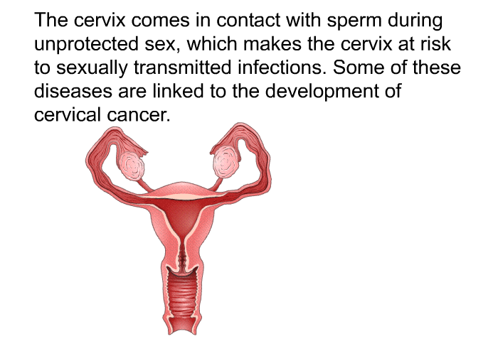 The cervix comes in contact with sperm during unprotected sex, which makes the cervix at risk to sexually transmitted infections. Some of these diseases are linked to the development of cervical cancer.
