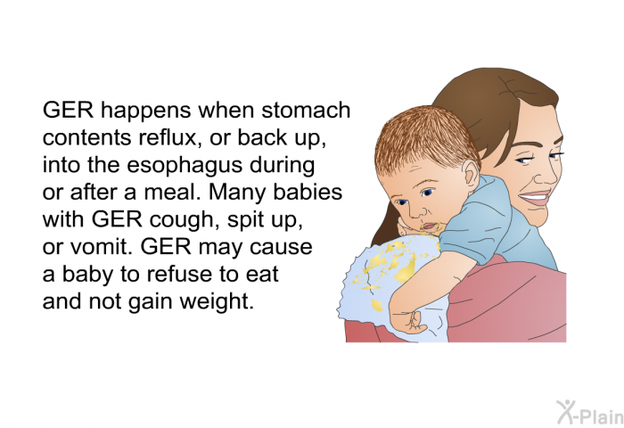 GER happens when stomach contents reflux, or back up, into the esophagus during or after a meal. Many babies with GER cough, spit up, or vomit. GER may cause a baby to refuse to eat and not gain weight.