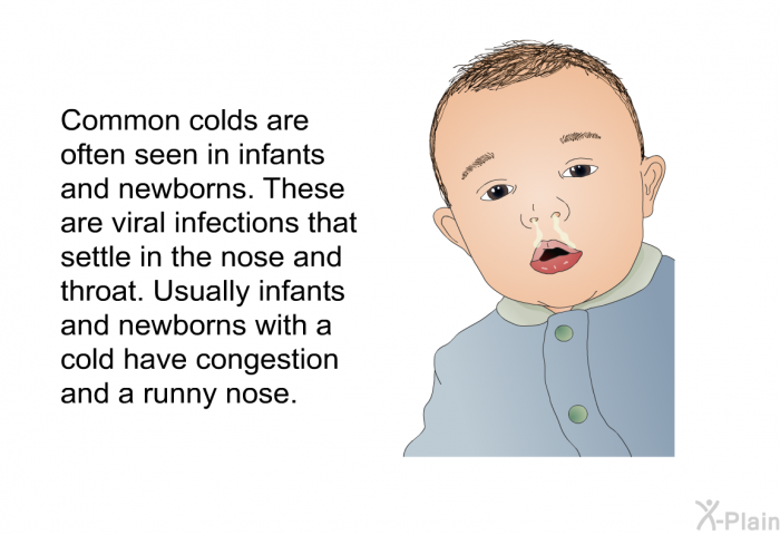 Common colds are often seen in infants and newborns. These are viral infections that settle in the nose and throat. Usually infants and newborns with a cold have congestion and a runny nose.