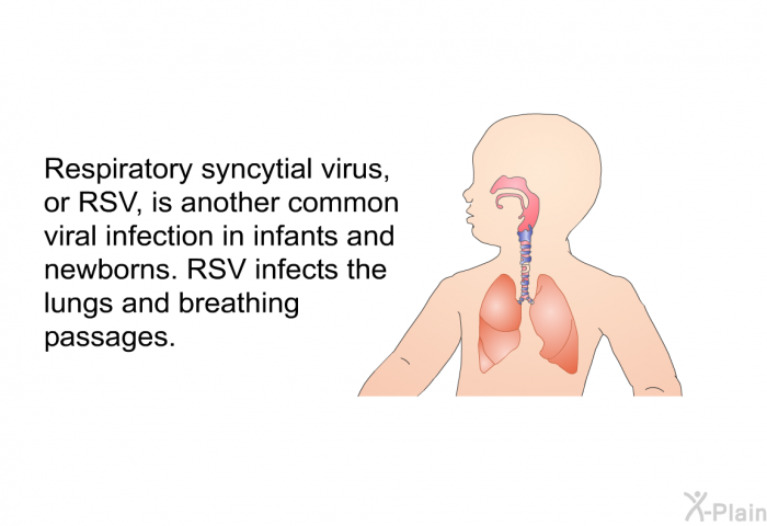 Respiratory syncytial virus, or RSV, is another common viral infection in infants and newborns. RSV infects the lungs and breathing passages.