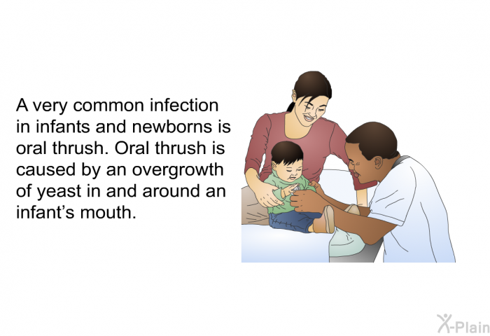 A very common infection in infants and newborns is oral thrush. Oral thrush is caused by an overgrowth of yeast in and around an infant's mouth.