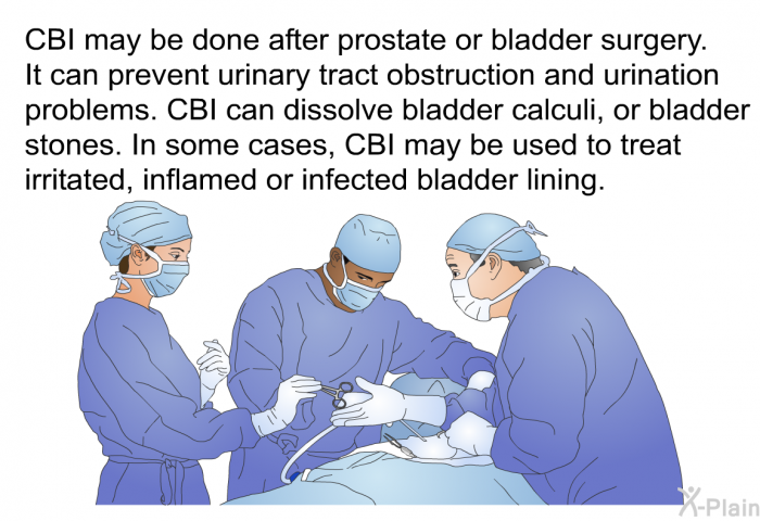 CBI may be done after prostate or bladder surgery. It can prevent urinary tract obstruction and urination problems. CBI can dissolve bladder calculi, or bladder stones. In some cases, CBI may be used to treat irritated, inflamed or infected bladder lining.