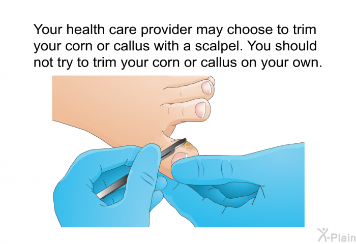 Your health care provider may choose to trim your corn or callus with a scalpel. You should not try to trim your corn or callus on your own.