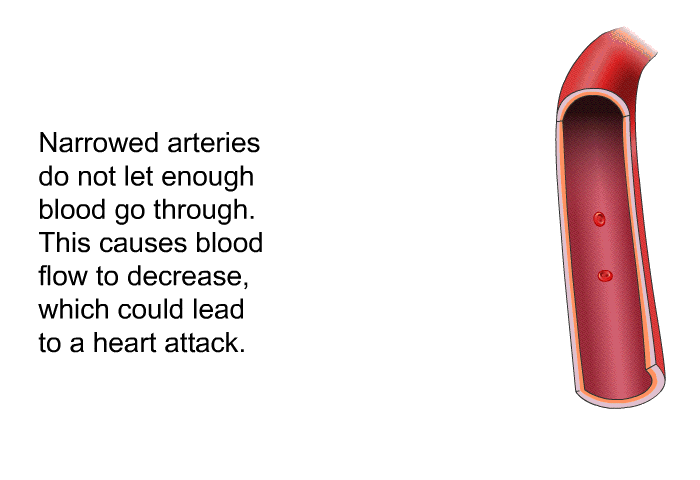 Narrowed arteries do not let enough blood go through. This causes blood flow to decrease, which could lead to a heart attack.