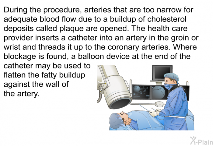 During the procedure, arteries that are too narrow for adequate blood flow due to a buildup of cholesterol deposits called plaque are opened. The health care provider inserts a catheter into an artery in the groin or wrist and threads it up to the coronary arteries. Where blockage is found, a balloon device at the end of the catheter may be used to flatten the fatty buildup against the wall of the artery.