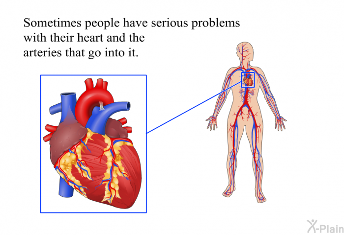 Sometimes people have serious problems with their heart and the arteries that go into it.