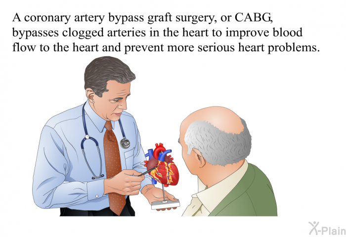 A coronary artery bypass graft surgery, or CABG, bypasses clogged arteries in the heart to improve blood flow to the heart and prevent more serious heart problems.