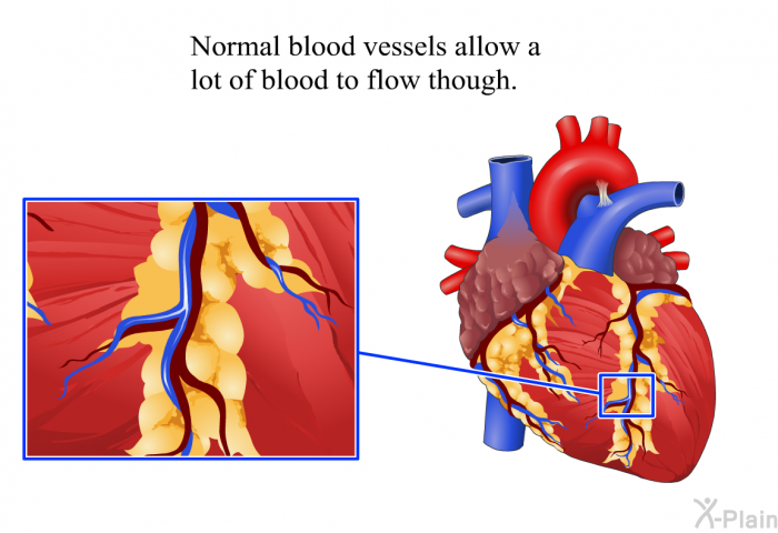 Normal blood vessels allow a lot of blood to flow though.