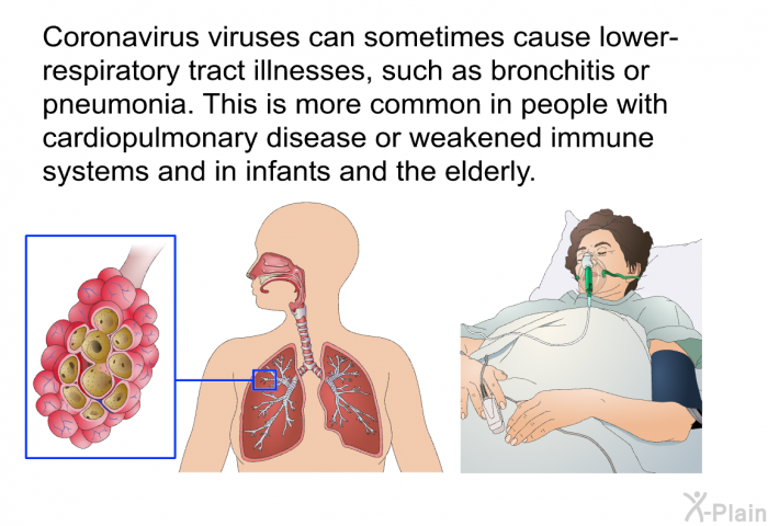 Coronavirus viruses can sometimes cause lower-respiratory tract illnesses, such as bronchitis or pneumonia. This is more common in people with cardiopulmonary disease or weakened immune systems and in infants and the elderly.