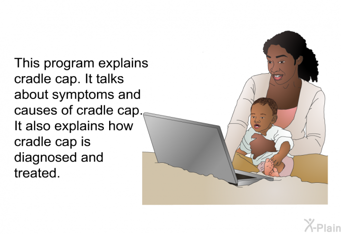 This health information explains cradle cap. It talks about symptoms and causes of cradle cap. It also explains how cradle cap is diagnosed and treated.