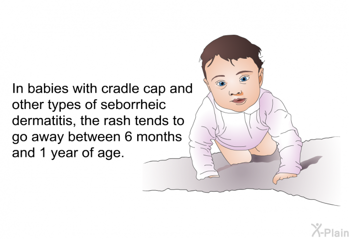 In babies with cradle cap and other types of seborrheic dermatitis, the rash tends to go away between 6 months and 1 year of age.