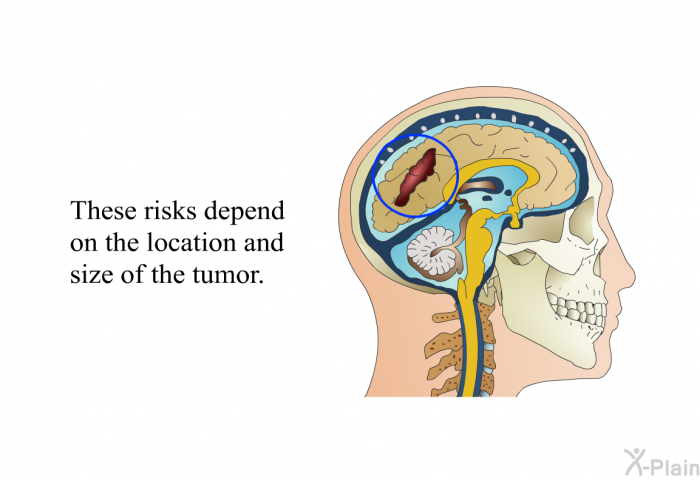 These risks depend on the location and size of the tumor.