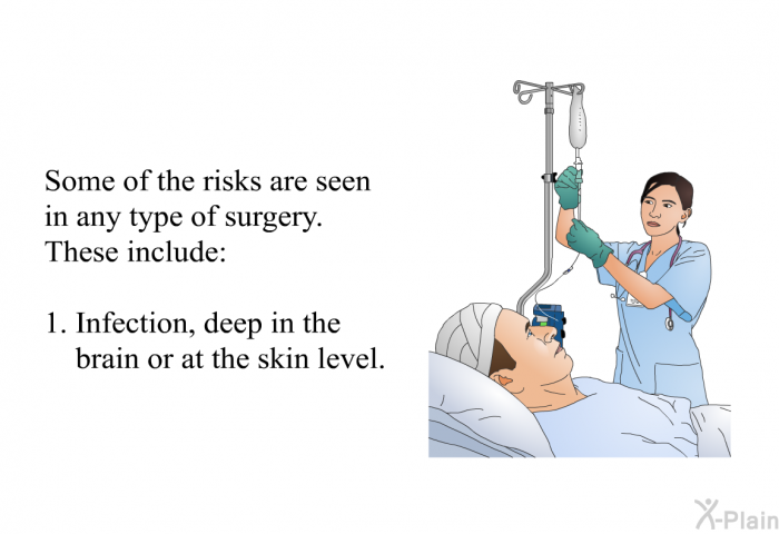 Some of the risks are seen in any type of surgery. These include:  Infection, deep in the brain or at the skin level.
