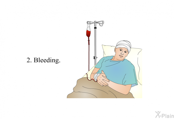Bleeding.