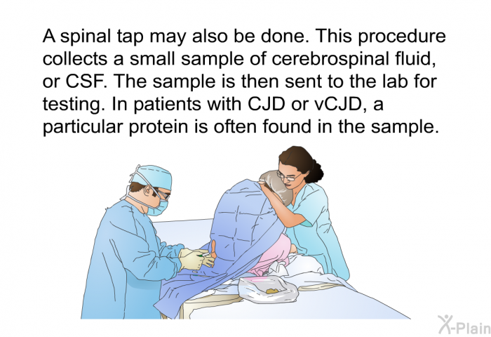 A spinal tap may also be done. This procedure collects a small sample of cerebrospinal fluid, or CSF. The sample is then sent to the lab for testing. In patients with CJD or vCJD, a particular protein is often found in the sample.