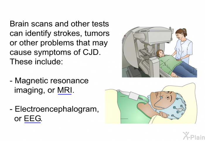 Brain scans and other tests can identify strokes, tumors or other problems that may cause symptoms of CJD. These include:  Magnetic resonance imaging, or MRI. Electroencephalogram, or EEG.