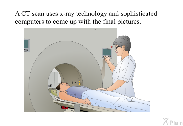 A CT scan uses x-ray technology and sophisticated computers to come up with the final pictures.