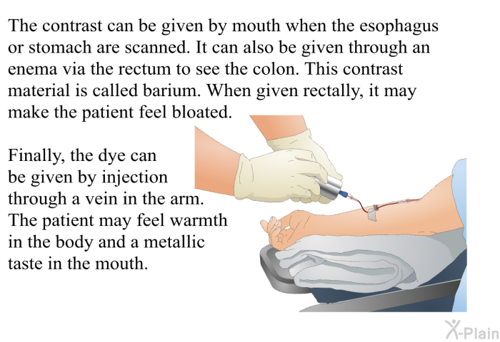 The contrast can be given by mouth when the esophagus or stomach are scanned. It can also be given through an enema via the rectum to see the colon. This contrast material is called barium. When given rectally, it may make the patient feel bloated. Finally, the dye can be given by injection through a vein in the arm. The patient may feel warmth in the body and a metallic taste in the mouth.