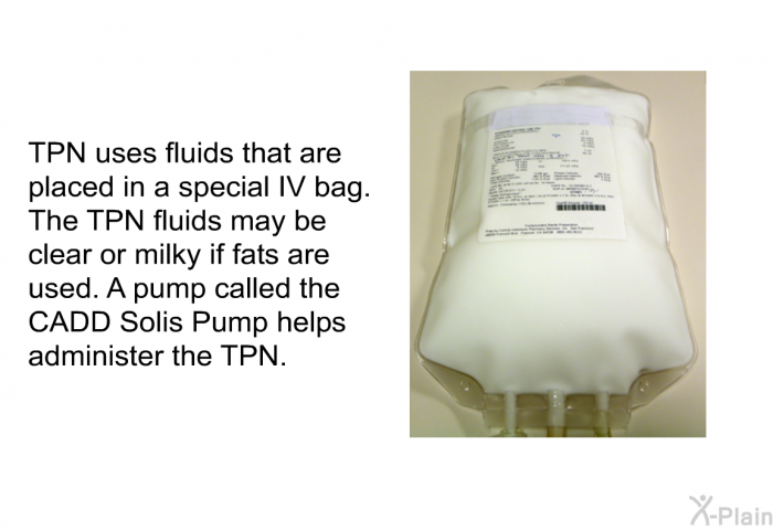 TPN uses fluids that are placed in a special IV bag. The TPN fluids may be clear or milky if fats are used. A pump called the CADD Solis Pump helps administer the TPN.
