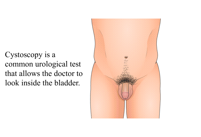 Cystoscopy is a common urological test that allows the doctor to look inside the bladder.