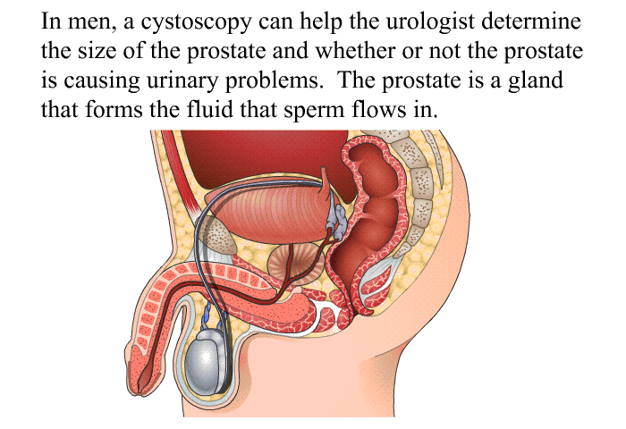In men, a cystoscopy can help the urologist determine the size of the prostate and whether or not the prostate is causing urinary problems. The prostate is a gland that forms the fluid that sperm flows in.