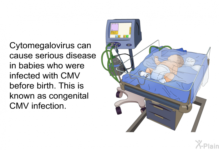 Cytomegalovirus can cause serious disease in babies who were infected with CMV before birth. This is known as congenital CMV infection.