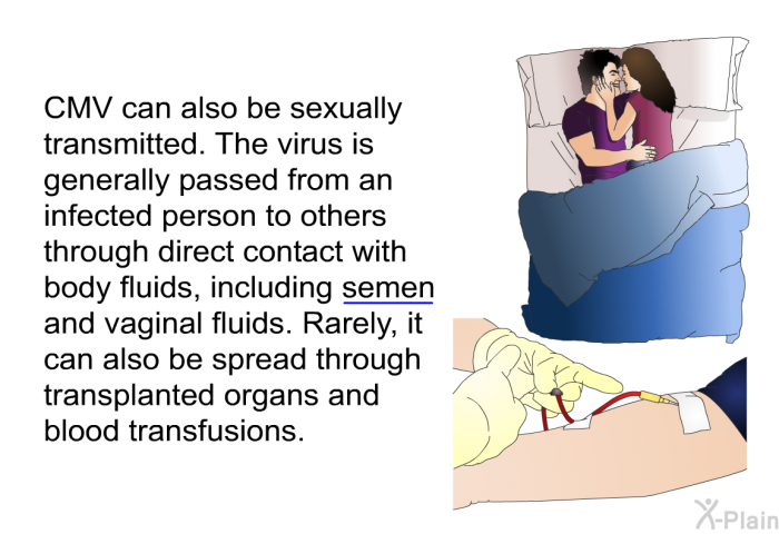 CMV can also be sexually transmitted. The virus is generally passed from an infected person to others through direct contact with body fluids, including semen and vaginal fluids. Rarely, it can also be spread through transplanted organs and blood transfusions.