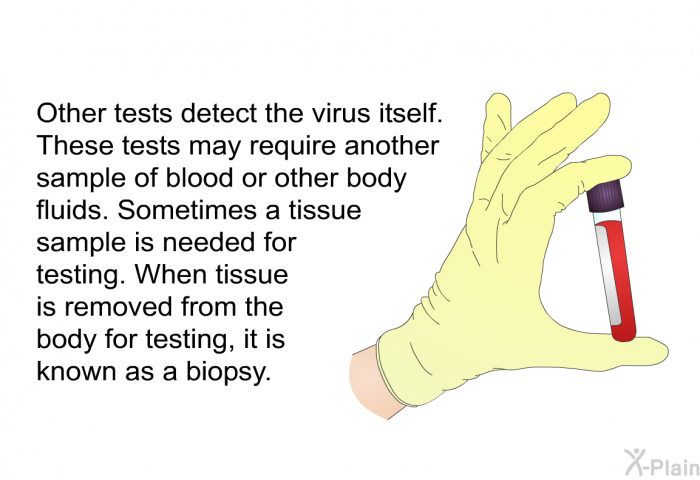 Other tests detect the virus itself. These tests may require another sample of blood or other body fluids. Sometimes a tissue sample is needed for testing. When tissue is removed from the body for testing, it is known as a biopsy.