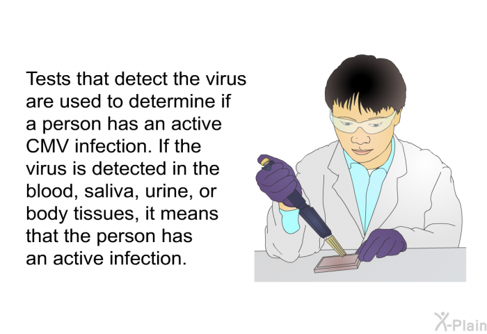 Tests that detect the virus are used to determine if a person has an active CMV infection. If the virus is detected in the blood, saliva, urine, or body tissues, it means that the person has an active infection.