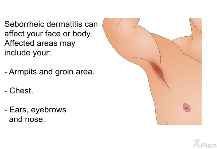 Seborrheic dermatitis can affect your face or body. Affected areas may include your:  Armpits and groin area. Chest. Ears, eyebrows and nose.