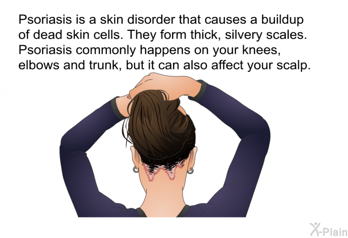 Psoriasis is a skin disorder that causes a buildup of dead skin cells. They form thick, silvery scales. Psoriasis commonly happens on your knees, elbows and trunk, but it can also affect your scalp.