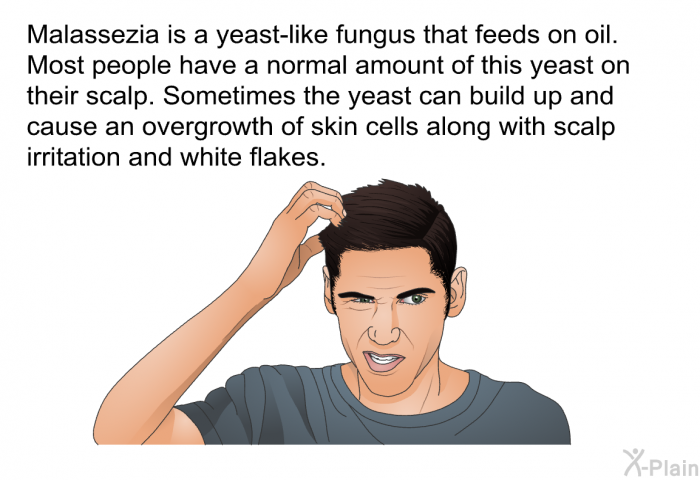 Malassezia is a yeast-like fungus that feeds on oil. Most people have a normal amount of this yeast on their scalp. Sometimes the yeast can build up and cause an overgrowth of skin cells along with scalp irritation and white flakes.