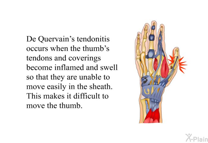 De Quervain's tendonitis occurs when the thumb's tendons and coverings become inflamed and swell so that they are unable to move easily in the sheath. This makes it difficult to move the thumb.