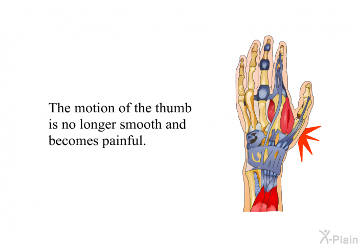 The motion of the thumb is no longer smooth and becomes painful.