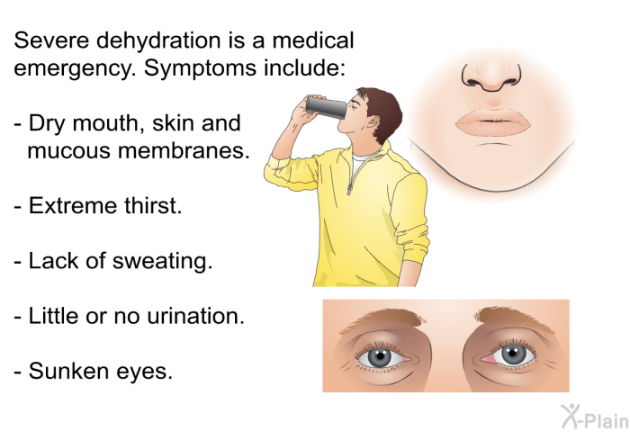 Severe dehydration is a medical emergency. Symptoms include:  Dry mouth, skin and mucous membranes. Extreme thirst. Lack of sweating. Little or no urination. Sunken eyes.