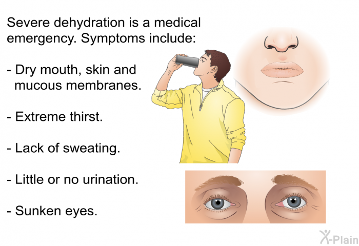 Severe dehydration is a medical emergency. Symptoms include:  Dry mouth, skin and mucous membranes. Extreme thirst. Lack of sweating. Little or no urination. Sunken eyes.