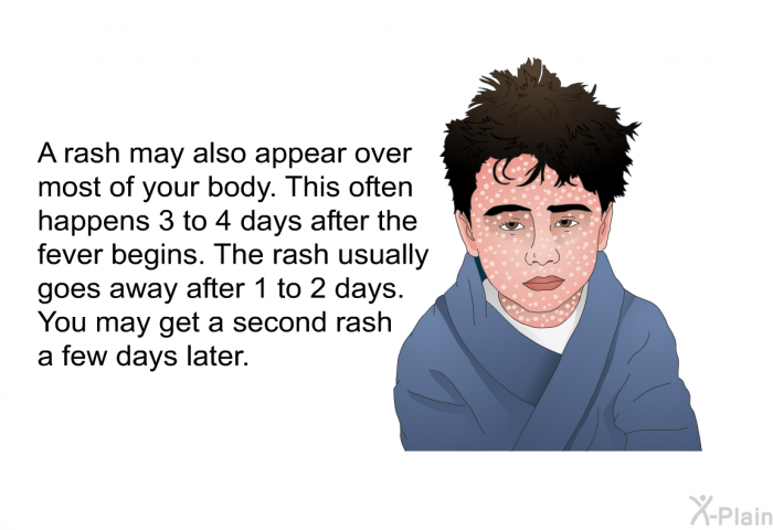 A rash may also appear over most of your body. This often happens 3 to 4 days after the fever begins. The rash usually goes away after 1 to 2 days. You may get a second rash a few days later.