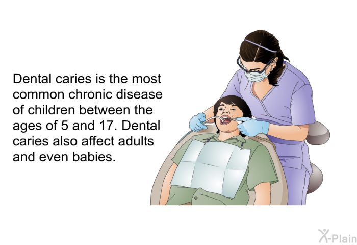 Dental caries is the most common chronic disease of children between the ages of 5 and 17. Dental caries also affect adults and even babies.