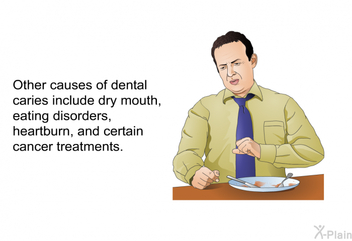 Other causes of dental caries include dry mouth, eating disorders, heartburn, and certain cancer treatments.