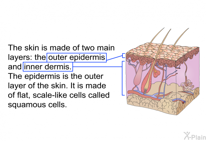 The skin is made of two main layers: the outer epidermis and inner dermis. The epidermis is the outer layer of the skin. It is made of flat, scale-like cells called squamous cells.