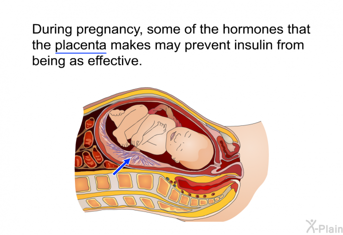 During pregnancy, some of the hormones that the placenta makes may prevent insulin from being as effective.
